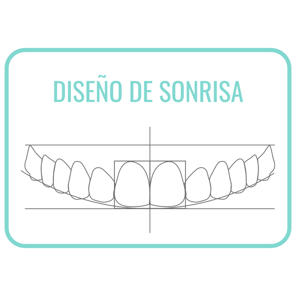 Diseño de sonrisa